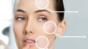 Post3 img1 e1541176074358